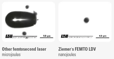 Z Femto 7D lézeres kezelésről