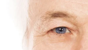 Szembetegségek - szemhéjplasztika -szemproblémák - lézere sezmműtét - kötőhártya gyulladás - keratoconus - szürkehályog műtét - ptosis - dermatochalasis
