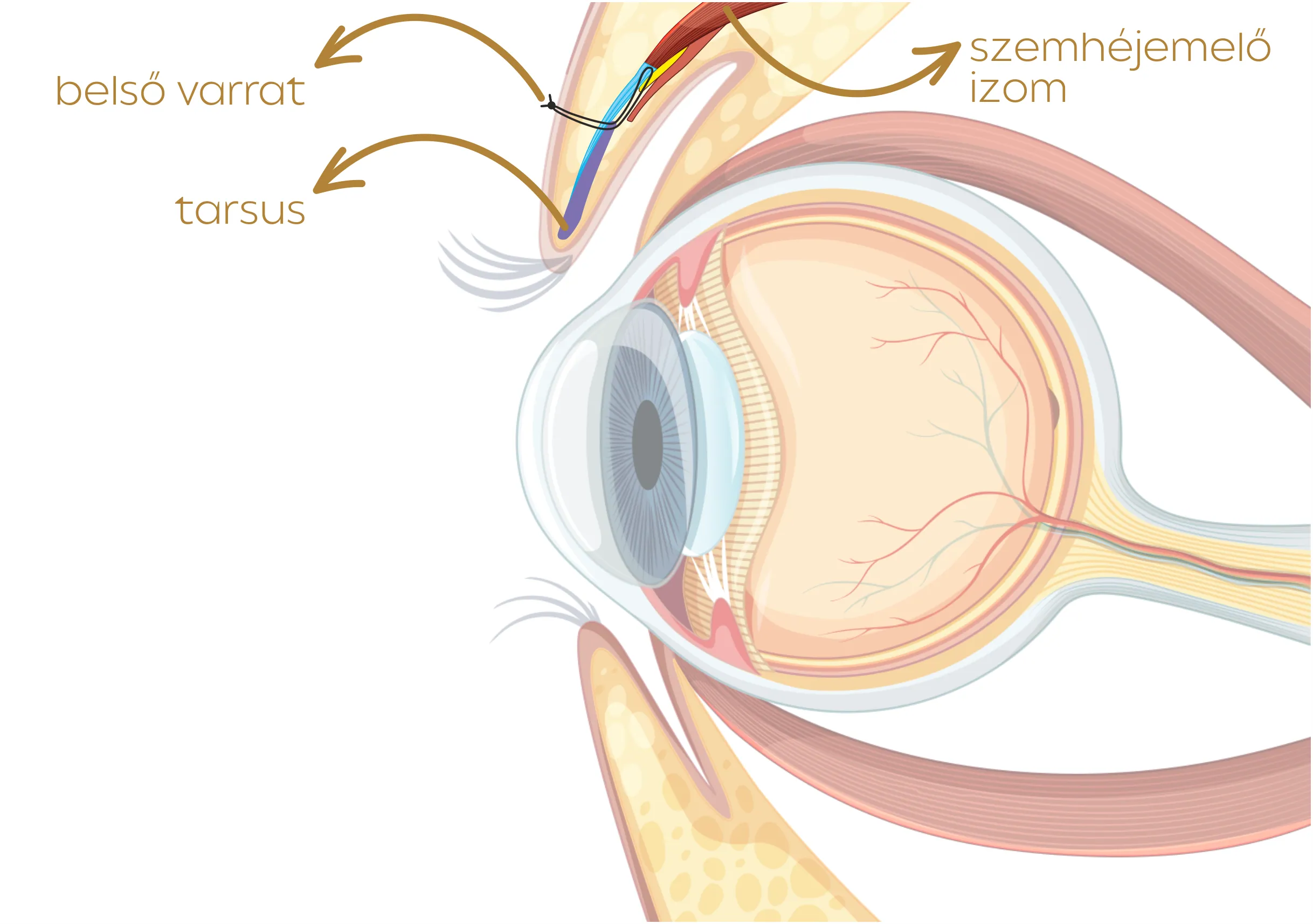 ptosis műtét - szemhéjcsüngés