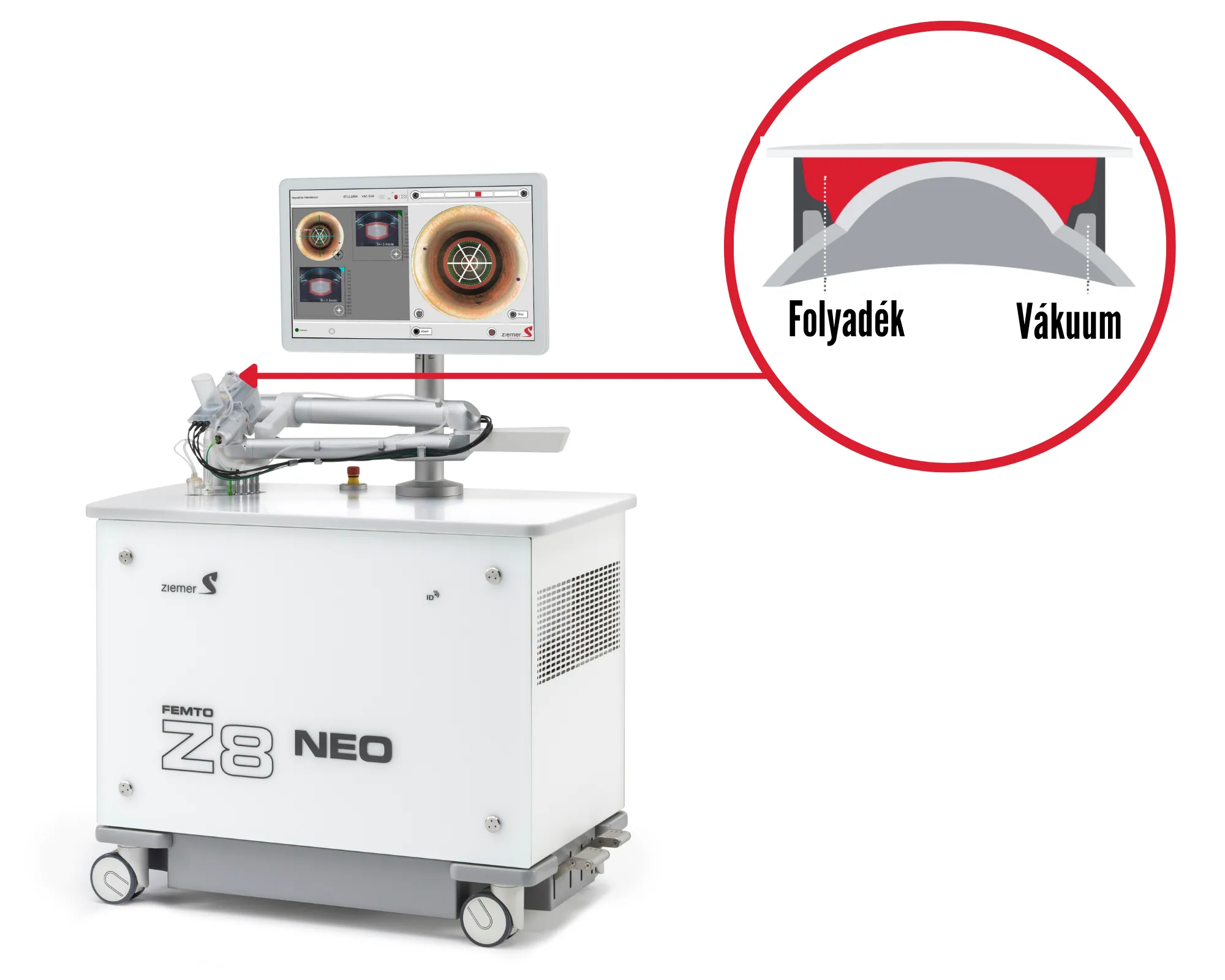 Ziemer Femto Z8 NEO - lézeres szemműtét - kíméletes lézeres kezelés
