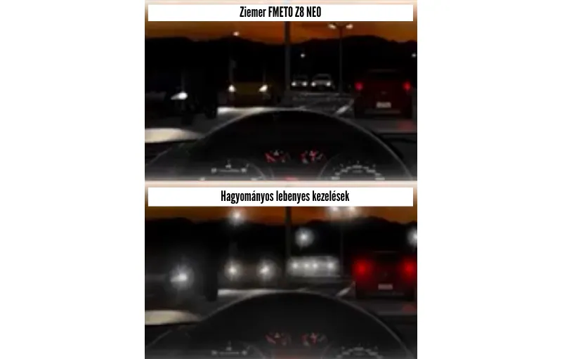 Ziemer Femto Z8 NEO - lézeres szemműtét - kíméletes lézeres kezelés - éjszakai látás