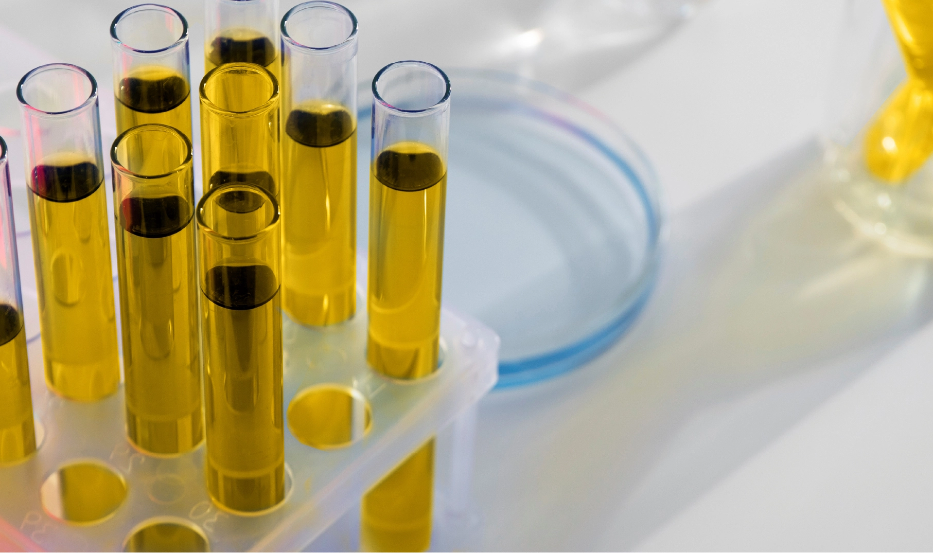 Saját vérsavós szemcsepp - szérum szemcsepp - saját savós PRP csepp -saját plazmás -szemcsepp - PRP